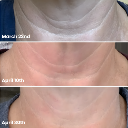 AuraLuxe Neck Cream™